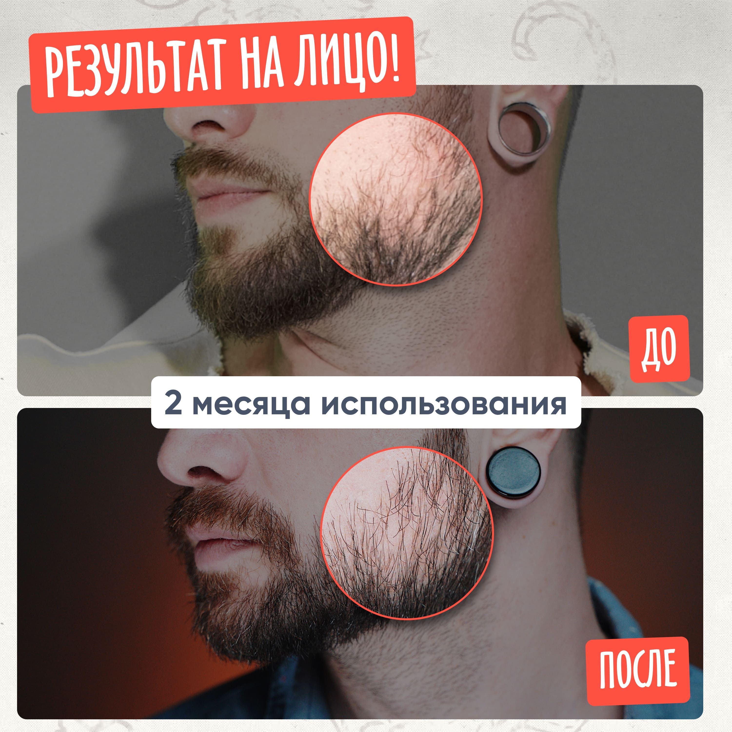 Borodist Средство для роста бороды "Beard Grower" (Бородист) - купить с  доставкой по выгодным ценам в интернет-магазине OZON (860296151)