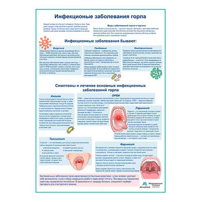 Инфекционные заболевания горла медицинский плакат A2+, плотная фотобумага от 200г/м2  #1