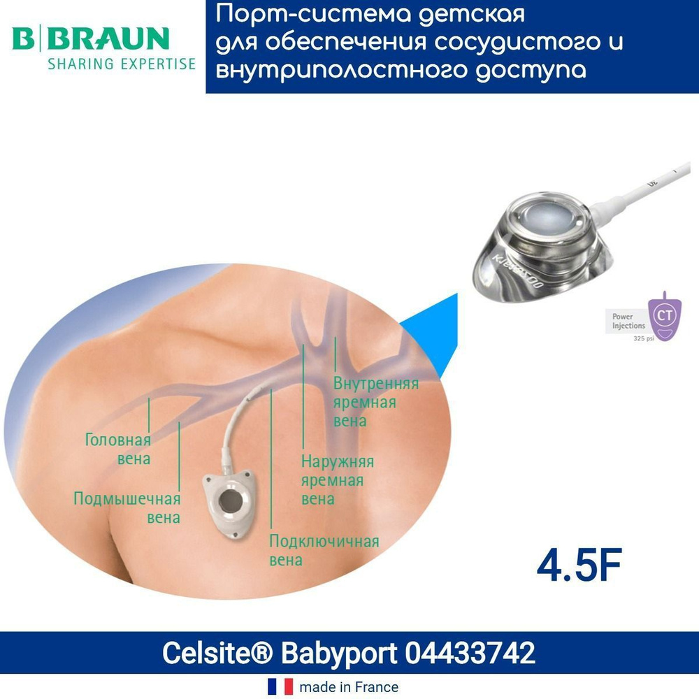 04433742 Венозная порт-система для химиотерапии Селсайт (B.Braun Celsite)  Epoxy Babyport 4,5F/1,5 мм, сверхмалый (детский) порт, полиуретановый ...