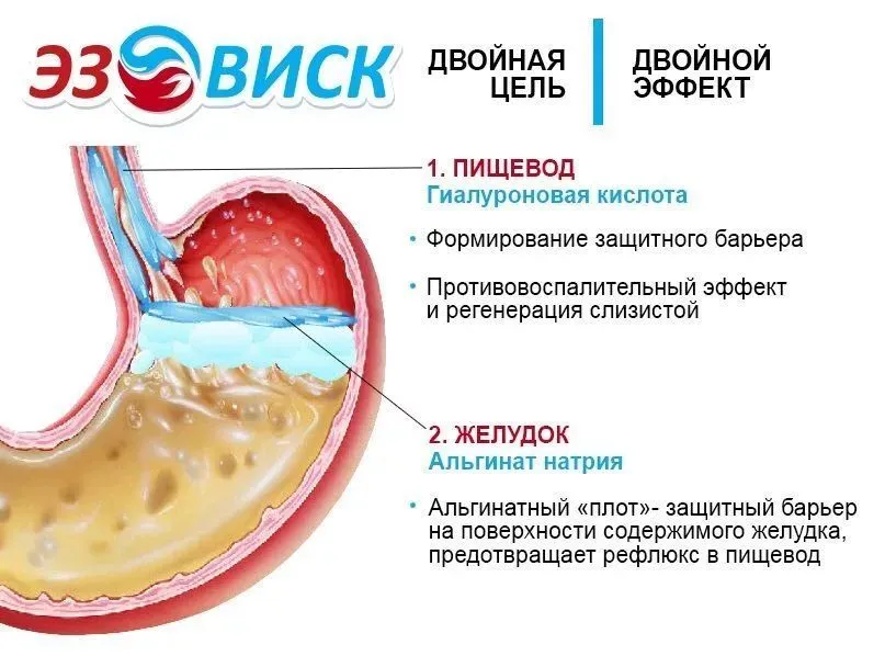 ЭЗОВИСК от изжоги, суспензия при ГЭРБ, эзофагопротектор, 20 саше по 10 мл., 10 мл, фото 4