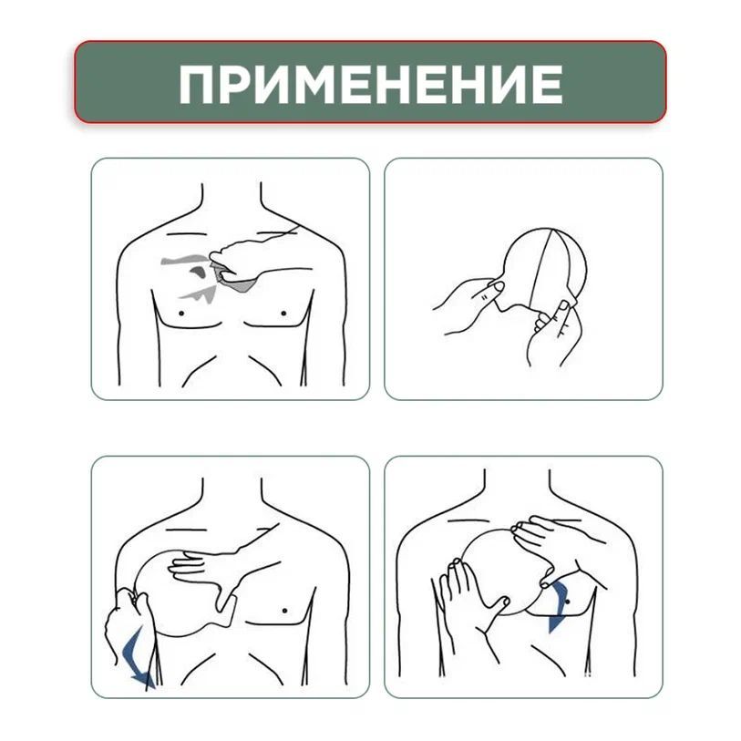 Порядок наложения элементов окклюзионной повязки. Индивидуальный перевязочный пакет при пневмотораксе. Пневмоторакс окклюзионная повязка. Пластырь для герметизации пневмоторакса. Окклюзионная повязка назначение.