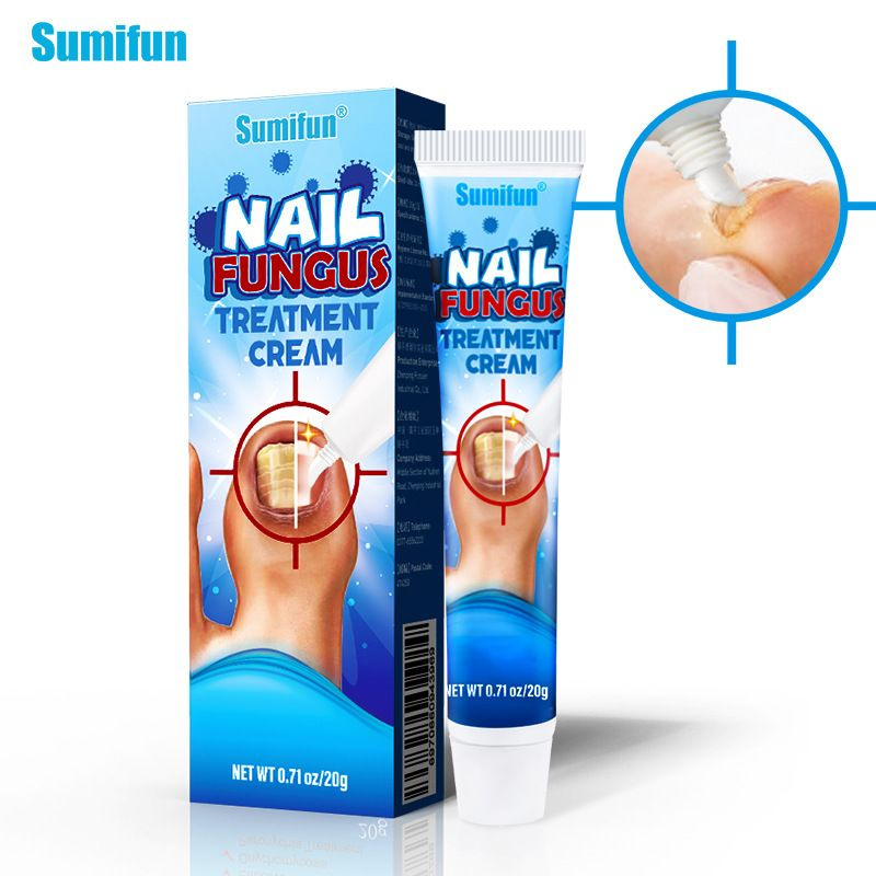 Sumifun Крем от грибка на ногтях ног и рук , противогрибковый, лечебный ...