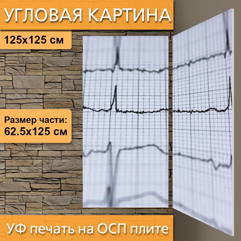 Угловая модульная картина "Экг, электрокардиограмма, медицина" для ...