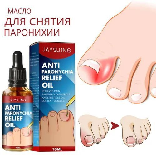 2023 Лучшее немецкое масло для снятия паронихии Toenail plus Nail Prop против паронихии 10 мл  #1