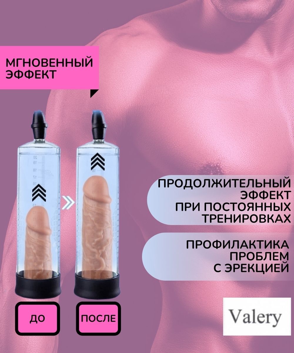 Работает ли операция по увеличению полового члена? Это опасно? — Москва