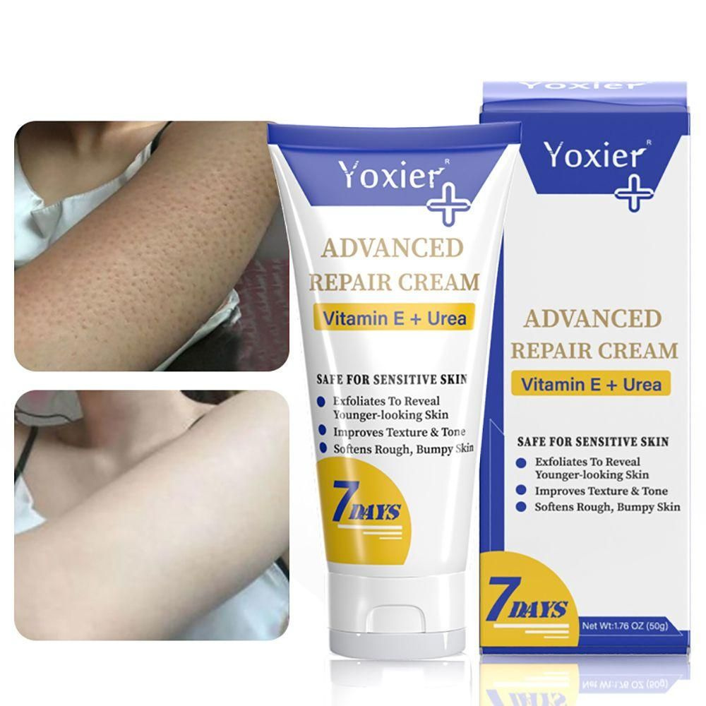 Крем для восстановления кожи куриных фолликулов от кератоза Pilaris для ...