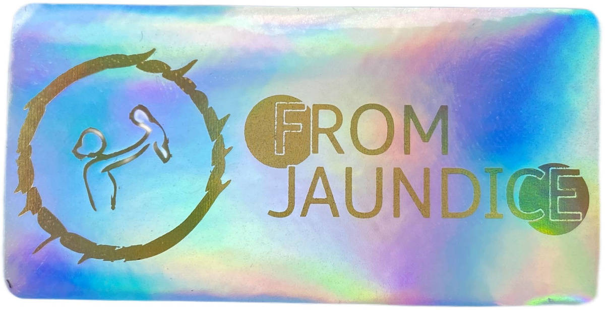 Лампа от желтушки для фототерапии новорожденного FROM JAUNDICE - купить ...