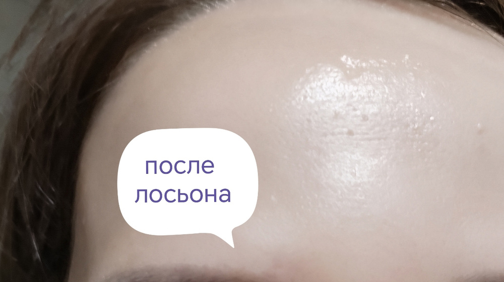 Гельтек Салициловый лосьон для лица Salicylic 2%, от прыщей, от черных ...