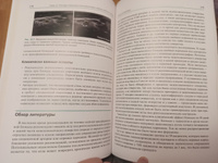 Ультразвуковая навигация в интервенционном лечении боли #6, Ирина Ч.