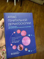 Атлас генитальной дерматоскопии. Кожные и венерические болезни гениталий, инфекционные заболевания кожи. Книга дерматовенерологу, гинекологу, урологу, врачу общей практики, студенту мед вуза #1, Ариф Курбанов 