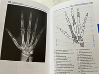 Карманный атлас рентгенологической анатомии. | Мёллер Торстен Б., Райф Эмиль #2, Анна Т.