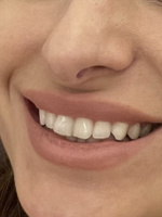 Global White Отбеливающие полоски для зубов с активным кислородом 2 саше / Две пары отбеливающих полосок_Мята #8, Юлиана К.