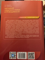 Нарушения сердечного ритма и проводимости | Обрезан Андрей Григорьевич #2, Римма М.