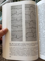 Руководство по ЭКГ электрокардиографии . Орлов. | Орлов Виктор Николаевич #1, Виталий Н.