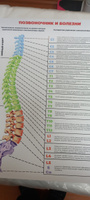Информационный медицинский плакат "Позвоночник и болезни" / А-2 (42x60 см.) #33, Алексей Б.