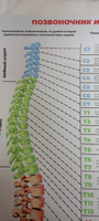 Информационный медицинский плакат "Позвоночник и болезни" / А-2 (42x60 см.) #34, Алексей Б.